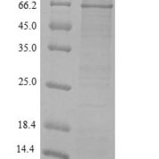 SDS-PAGE separation of QP6369 followed by commassie total protein stain results in a primary band consistent with reported data for MMP-2 / CLG4A Protein. These data demonstrate Greater than 90% as determined by SDS-PAGE.