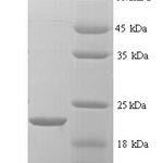 SDS-PAGE separation of QP6371 followed by commassie total protein stain results in a primary band consistent with reported data for MMP7. These data demonstrate Greater than 90% as determined by SDS-PAGE.