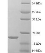 SDS-PAGE separation of QP6371 followed by commassie total protein stain results in a primary band consistent with reported data for MMP7. These data demonstrate Greater than 90% as determined by SDS-PAGE.