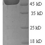 SDS-PAGE separation of QP6374 followed by commassie total protein stain results in a primary band consistent with reported data for Mannose-6-phosphate isomerase. These data demonstrate Greater than 90% as determined by SDS-PAGE.