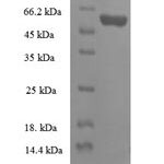 SDS-PAGE separation of QP6381 followed by commassie total protein stain results in a primary band consistent with reported data for 39S ribosomal protein L19