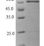 SDS-PAGE separation of QP6385 followed by commassie total protein stain results in a primary band consistent with reported data for 28S ribosomal protein S22