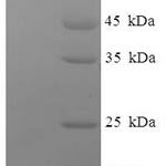 SDS-PAGE separation of QP6397 followed by commassie total protein stain results in a primary band consistent with reported data for Major Vault Protein. These data demonstrate Greater than 90% as determined by SDS-PAGE.