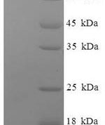 SDS-PAGE separation of QP6397 followed by commassie total protein stain results in a primary band consistent with reported data for Major Vault Protein. These data demonstrate Greater than 90% as determined by SDS-PAGE.
