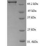 SDS-PAGE separation of QP6398 followed by commassie total protein stain results in a primary band consistent with reported data for c-Myc Oncoprotein. These data demonstrate Greater than 90% as determined by SDS-PAGE.