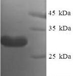 SDS-PAGE separation of QP6402 followed by commassie total protein stain results in a primary band consistent with reported data for Nanos homolog 2. These data demonstrate Greater than 90% as determined by SDS-PAGE.