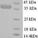 SDS-PAGE separation of QP6403 followed by commassie total protein stain results in a primary band consistent with reported data for Nicotinate phosphoribosyltransferase. These data demonstrate Greater than 90% as determined by SDS-PAGE.