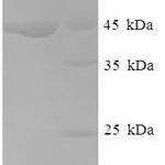 SDS-PAGE separation of QP6411 followed by commassie total protein stain results in a primary band consistent with reported data for NDUFA6. These data demonstrate Greater than 90% as determined by SDS-PAGE.