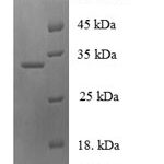 SDS-PAGE separation of QP6418 followed by commassie total protein stain results in a primary band consistent with reported data for Neuroglobin. These data demonstrate Greater than 90% as determined by SDS-PAGE.