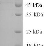 SDS-PAGE separation of QP6419 followed by commassie total protein stain results in a primary band consistent with reported data for Protein BEX3. These data demonstrate Greater than 90% as determined by SDS-PAGE.