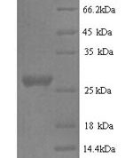 SDS-PAGE separation of QP6420 followed by commassie total protein stain results in a primary band consistent with reported data for Nidogen-1. These data demonstrate Greater than 90% as determined by SDS-PAGE.