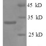 SDS-PAGE separation of QP6422 followed by commassie total protein stain results in a primary band consistent with reported data for NK-tumor recognition protein. These data demonstrate Greater than 90% as determined by SDS-PAGE.