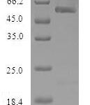 SDS-PAGE separation of QP6426 followed by commassie total protein stain results in a primary band consistent with reported data for Nicotinamide N-methyltransferase. These data demonstrate Greater than 80% as determined by SDS-PAGE.