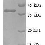 SDS-PAGE separation of QP6428 followed by commassie total protein stain results in a primary band consistent with reported data for Nephrocystin-1. These data demonstrate Greater than 90% as determined by SDS-PAGE.