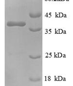 SDS-PAGE separation of QP6428 followed by commassie total protein stain results in a primary band consistent with reported data for Nephrocystin-1. These data demonstrate Greater than 90% as determined by SDS-PAGE.