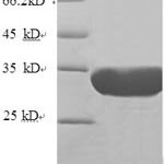 SDS-PAGE separation of QP6440 followed by commassie total protein stain results in a primary band consistent with reported data for Nuclear pore membrane glycoprotein 210. These data demonstrate Greater than 90% as determined by SDS-PAGE.