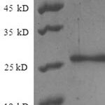 SDS-PAGE separation of QP6441 followed by commassie total protein stain results in a primary band consistent with reported data for Nuclear pore membrane glycoprotein 210. These data demonstrate Greater than 90% as determined by SDS-PAGE.