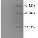 SDS-PAGE separation of QP6443 followed by commassie total protein stain results in a primary band consistent with reported data for Nuclear RNA export factor 3. These data demonstrate Greater than 90% as determined by SDS-PAGE.