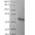 SDS-PAGE separation of QP6444 followed by commassie total protein stain results in a primary band consistent with reported data for Oncomodulin. These data demonstrate Greater than 90% as determined by SDS-PAGE.