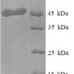 SDS-PAGE separation of QP6449 followed by commassie total protein stain results in a primary band consistent with reported data for OGN / osteoglycin. These data demonstrate Greater than 90% as determined by SDS-PAGE.