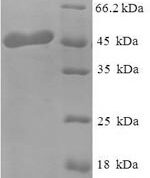 SDS-PAGE separation of QP6449 followed by commassie total protein stain results in a primary band consistent with reported data for OGN / osteoglycin. These data demonstrate Greater than 90% as determined by SDS-PAGE.
