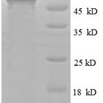 SDS-PAGE separation of QP6451 followed by commassie total protein stain results in a primary band consistent with reported data for Obg-like ATPase 1. These data demonstrate Greater than 90% as determined by SDS-PAGE.