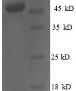 SDS-PAGE separation of QP6458 followed by commassie total protein stain results in a primary band consistent with reported data for Homeobox protein OTX2. These data demonstrate Greater than 90% as determined by SDS-PAGE.