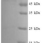 SDS-PAGE separation of QP6464 followed by commassie total protein stain results in a primary band consistent with reported data for Serine / threonine-protein kinase PAK 4. These data demonstrate Greater than 90% as determined by SDS-PAGE.