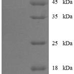 SDS-PAGE separation of QP6466 followed by commassie total protein stain results in a primary band consistent with reported data for E3 ubiquitin-protein ligase parkin. These data demonstrate Greater than 90% as determined by SDS-PAGE.