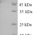 SDS-PAGE separation of QP6467 followed by commassie total protein stain results in a primary band consistent with reported data for Poly(A)-specific ribonuclease PARN. These data demonstrate Greater than 90% as determined by SDS-PAGE.