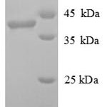 SDS-PAGE separation of QP6468 followed by commassie total protein stain results in a primary band consistent with reported data for Poly [ADP-ribose] polymerase 1. These data demonstrate Greater than 90% as determined by SDS-PAGE.