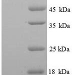 SDS-PAGE separation of QP6469 followed by commassie total protein stain results in a primary band consistent with reported data for PCK1. These data demonstrate Greater than 90% as determined by SDS-PAGE.