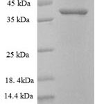 SDS-PAGE separation of QP6474 followed by commassie total protein stain results in a primary band consistent with reported data for Pcsk5. These data demonstrate Greater than 90% as determined by SDS-PAGE.