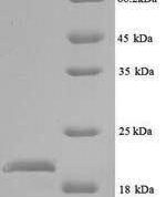 SDS-PAGE separation of QP6476 followed by commassie total protein stain results in a primary band consistent with reported data for Peptide deformylase. These data demonstrate Greater than 90% as determined by SDS-PAGE.