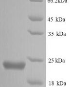 SDS-PAGE separation of QP6478 followed by commassie total protein stain results in a primary band consistent with reported data for Peptide deformylase. These data demonstrate Greater than 90% as determined by SDS-PAGE.