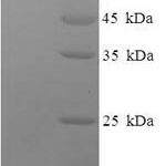 SDS-PAGE separation of QP6487 followed by commassie total protein stain results in a primary band consistent with reported data for Phosphoacetylglucosamine mutase. These data demonstrate Greater than 90% as determined by SDS-PAGE.