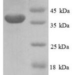 SDS-PAGE separation of QP6490 followed by commassie total protein stain results in a primary band consistent with reported data for PHD finger-like domain-containing protein 5A. These data demonstrate Greater than 90% as determined by SDS-PAGE.