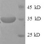 SDS-PAGE separation of QP6496 followed by commassie total protein stain results in a primary band consistent with reported data for Pituitary homeobox 3. These data demonstrate Greater than 90% as determined by SDS-PAGE.