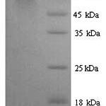 SDS-PAGE separation of QP6498 followed by commassie total protein stain results in a primary band consistent with reported data for PKLR / PKRL. These data demonstrate Greater than 90% as determined by SDS-PAGE.