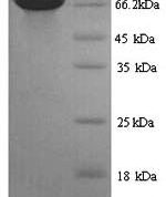 SDS-PAGE separation of QP6498 followed by commassie total protein stain results in a primary band consistent with reported data for PKLR / PKRL. These data demonstrate Greater than 90% as determined by SDS-PAGE.