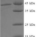 SDS-PAGE separation of QP6502 followed by commassie total protein stain results in a primary band consistent with reported data for tPA / PLAT. These data demonstrate Greater than 90% as determined by SDS-PAGE.