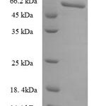 SDS-PAGE separation of QP6503 followed by commassie total protein stain results in a primary band consistent with reported data for PLAUR / CD87 / uPAR. These data demonstrate Greater than 90% as determined by SDS-PAGE.