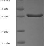 SDS-PAGE separation of QP6520 followed by commassie total protein stain results in a primary band consistent with reported data for Protein phosphatase 1B. These data demonstrate Greater than 90% as determined by SDS-PAGE.