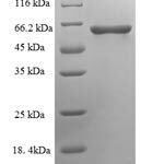 SDS-PAGE separation of QP6523 followed by commassie total protein stain results in a primary band consistent with reported data for PPP3CC. These data demonstrate Greater than 90% as determined by SDS-PAGE.