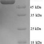 SDS-PAGE separation of QP6524 followed by commassie total protein stain results in a primary band consistent with reported data for PRAME. These data demonstrate Greater than 90% as determined by SDS-PAGE.