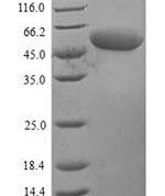SDS-PAGE separation of QP6525 followed by commassie total protein stain results in a primary band consistent with reported data for Perforin-1. These data demonstrate Greater than 80% as determined by SDS-PAGE.