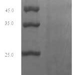 SDS-PAGE separation of QP6526 followed by commassie total protein stain results in a primary band consistent with reported data for Perforin-1. These data demonstrate Greater than 80% as determined by SDS-PAGE.