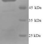 SDS-PAGE separation of QP6527 followed by commassie total protein stain results in a primary band consistent with reported data for Perforin-1. These data demonstrate Greater than 84.2% as determined by SDS-PAGE.