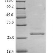 SDS-PAGE separation of QP6531 followed by commassie total protein stain results in a primary band consistent with reported data for Prolactin / PRL. These data demonstrate Greater than 90% as determined by SDS-PAGE.