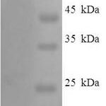 SDS-PAGE separation of QP6533 followed by commassie total protein stain results in a primary band consistent with reported data for PROS1  / . These data demonstrate Greater than 90% as determined by SDS-PAGE.